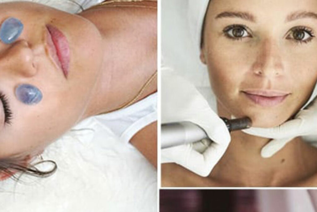 Bali’s Best Anti-Aging Facials